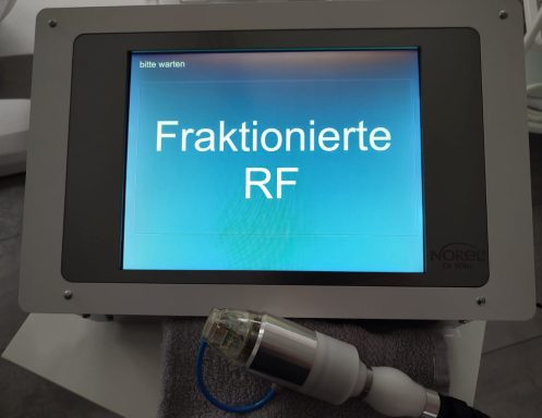 RF Needling