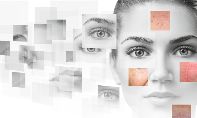 Verschiedene Hautzustände